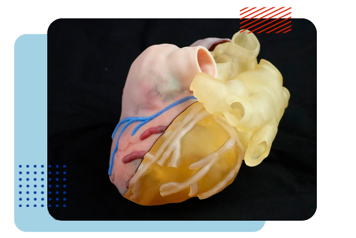 Innovaciones para obtener modelos anatómicos impresos en 3D