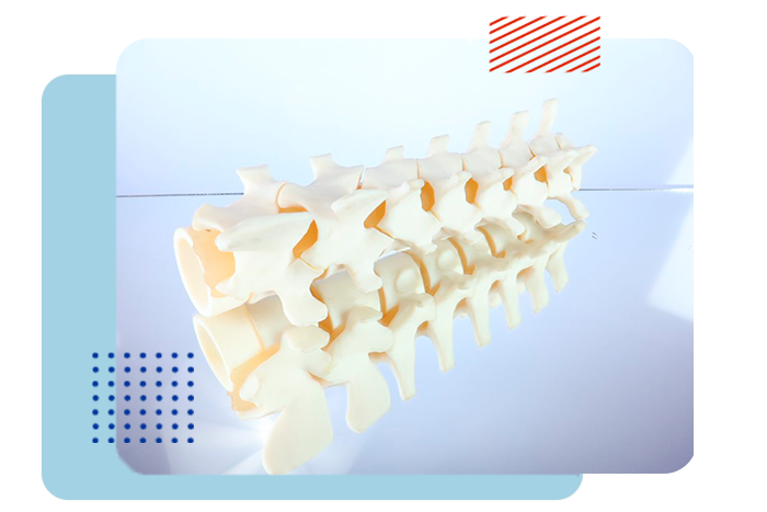 Modelos quirúrgicos impresos en 3D que mejoran la cirugía